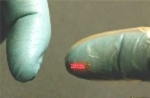 Content Dam Leds En Articles 2010 10 Flexible Led Arrays Target Biomedical Applications Leftcolumn Article Thumbnailimage File